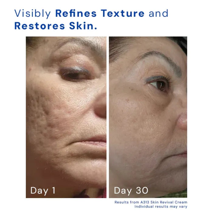 Céleste Essence: A313 Skin Revival Cream