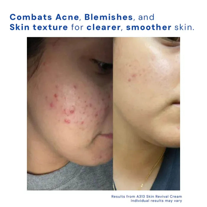 Céleste Essence: A313 Skin Revival Cream